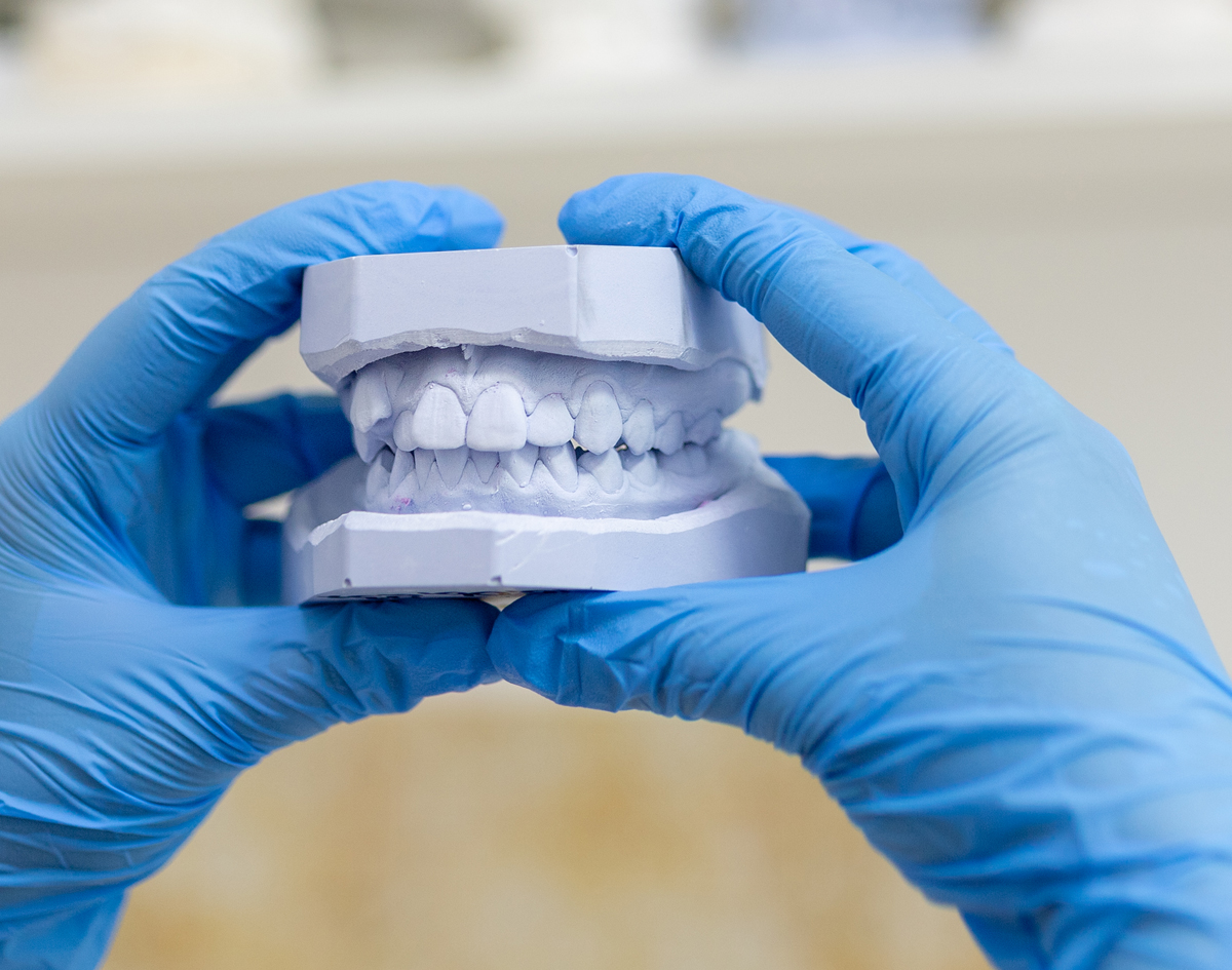 Plaster Cast Teeth